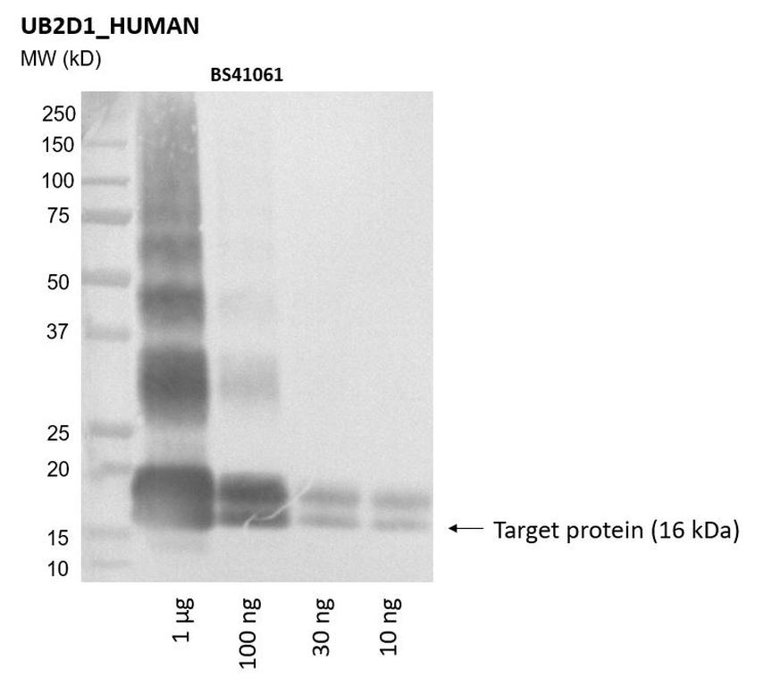 Ankyron UB2D1_HUMAN Clone BS41061