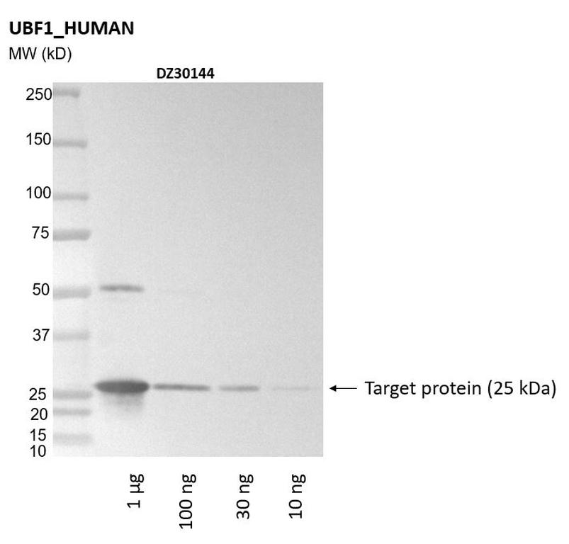 Ankyron UBF1_HUMAN Clone DZ30144