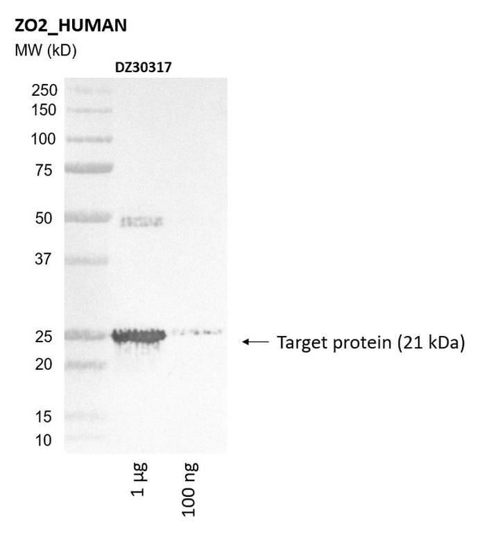 Ankyron ZO2_HUMAN Clone DZ30317