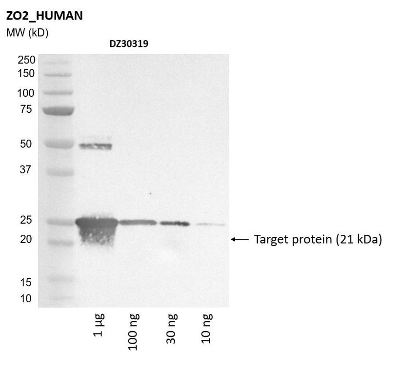 Ankyron ZO2_HUMAN Clone DZ30319