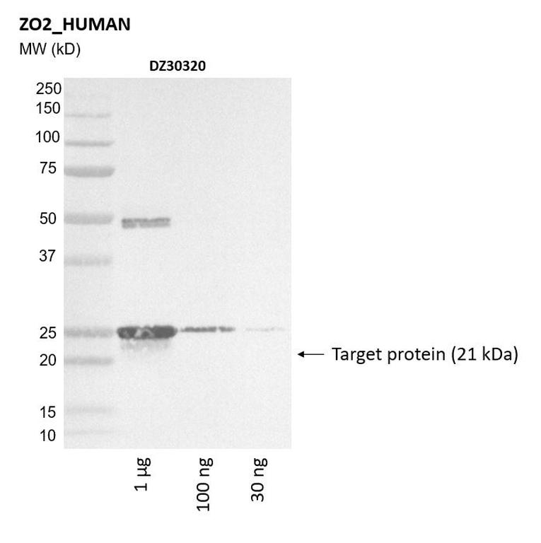 Ankyron ZO2_HUMAN Clone DZ30320