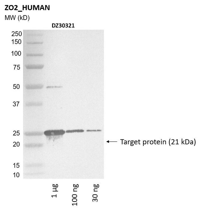 Ankyron ZO2_HUMAN Clone DZ30321